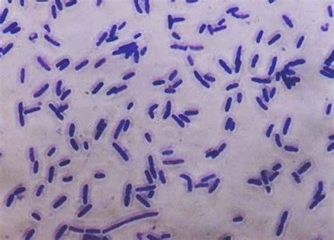 bacillus subtilis negative stain|4.2: Specialized Bacterial Staining Techniques.